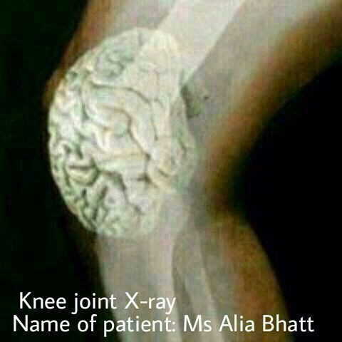 alia-bhatt-dumb-meme-jokes-on-jokofy (2)